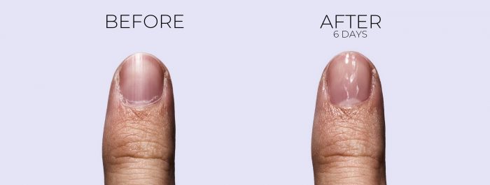OPI Nail Envy before and after